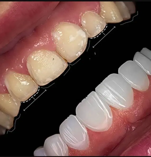 آف ویژه خدمات دندانپزشکی/وایمپلنت17800 بدون پیش|خدمات زیبایی و سلامت|اصفهان, مصلی|دیوار