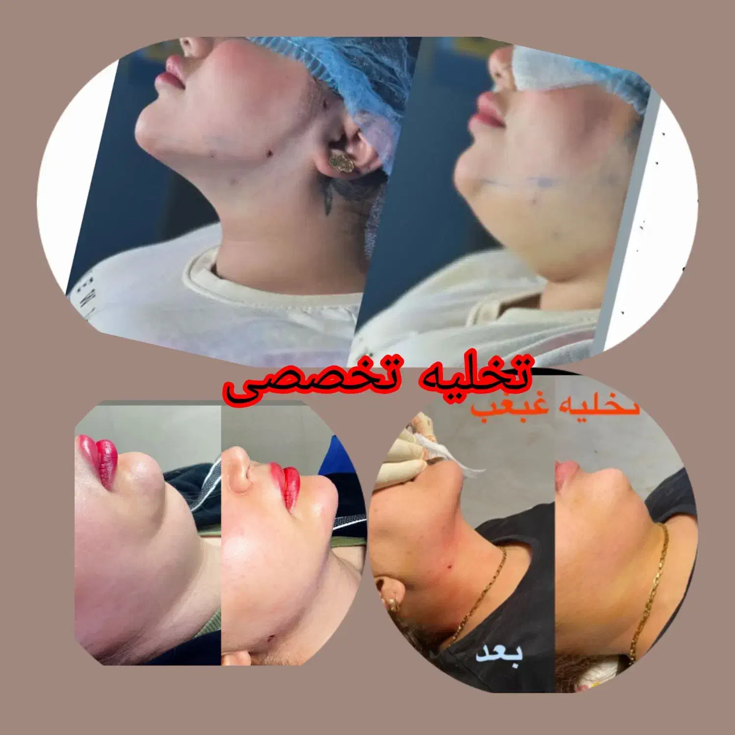 جراحی لابیا پلاستی .چربی صورت وبدن|خدمات آرایشگری و زیبایی|رباط‌کریم, رباط‌کریم|دیوار