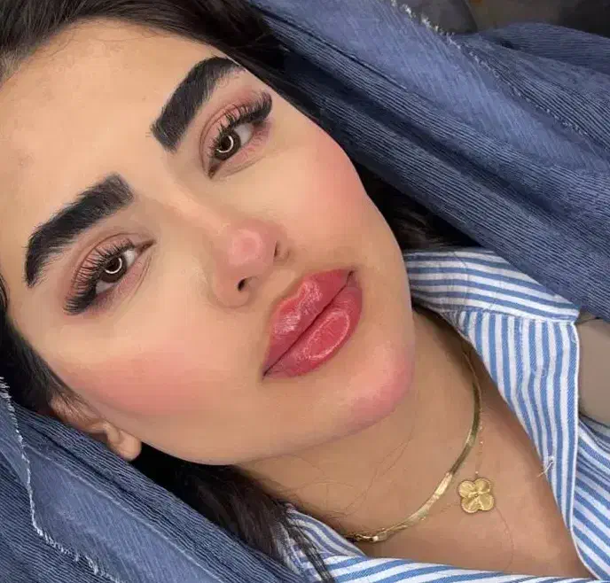 تخفیفات باور نکردین ژل،بوتاکس،آنزیم ،چال گونه|خدمات آرایشگری و زیبایی|کرمانشاه, |دیوار