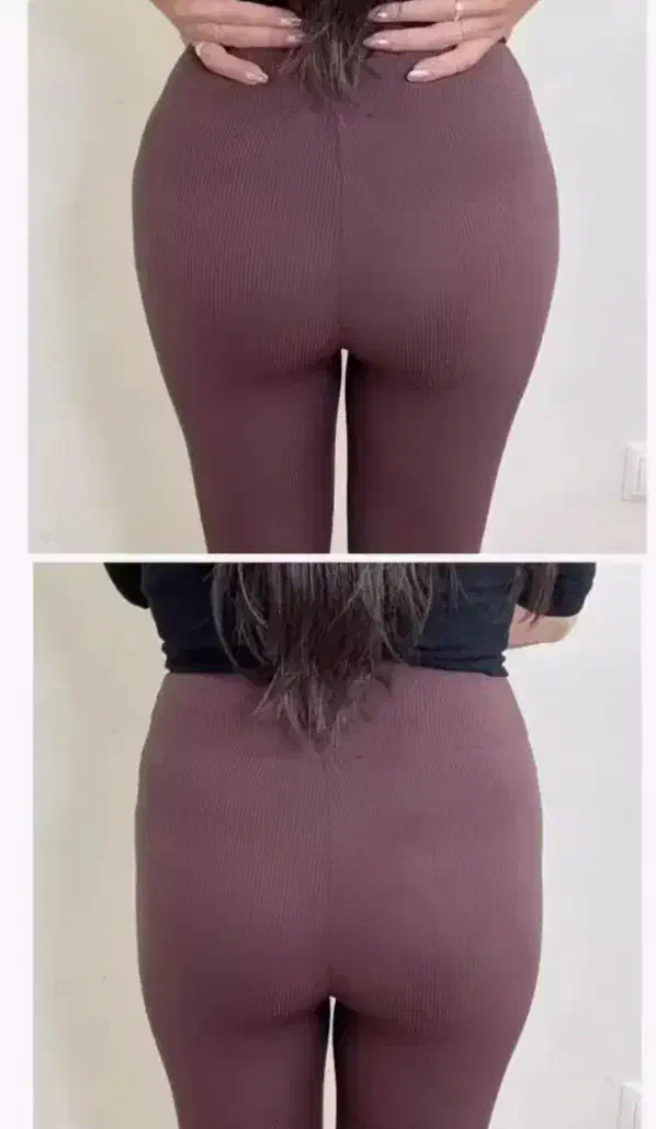 بوتاکس فیلر تخصصی و فیلر بادی و پی ارپی|خدمات آرایشگری و زیبایی|کرمانشاه, |دیوار