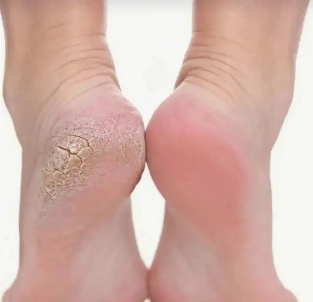 پدیکور خشک|خدمات آرایشگری و زیبایی|مریوان, |دیوار