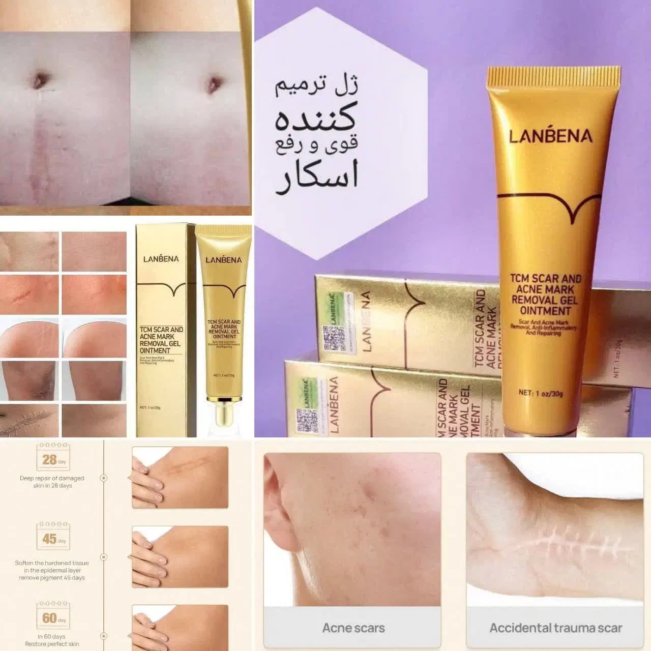 ماه گرفته گی|حراج|آران و بیدگل, |دیوار