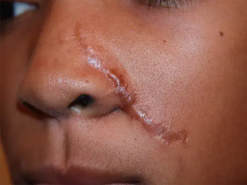 پی بی سرم کانتورینگ|خدمات آرایشگری و زیبایی|رشت, بلوار گیلان|دیوار