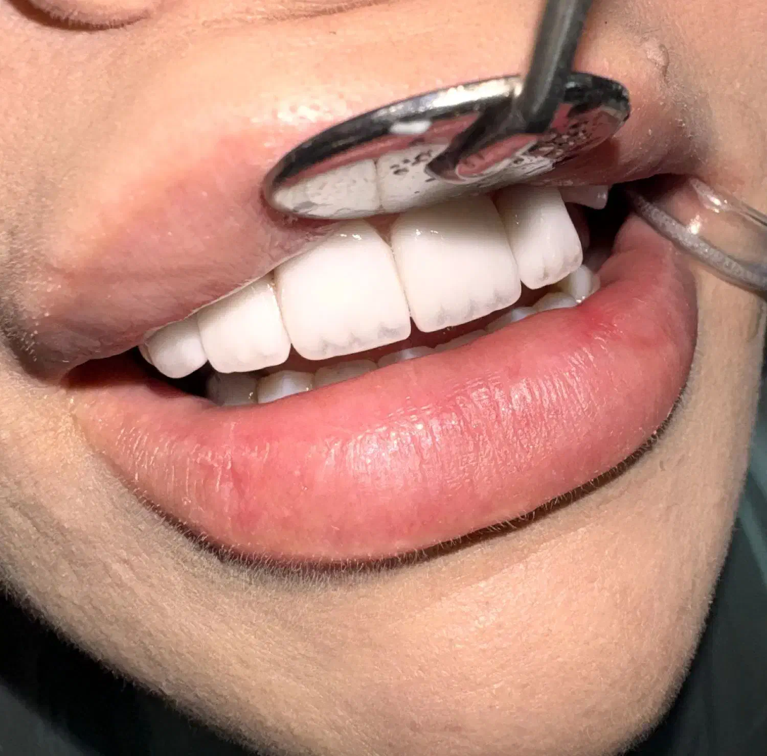 دندانپزشکی هرا ویزیت مشاوره رایگان|خدمات آرایشگری و زیبایی|اندیشه, اندیشه فاز ۳|دیوار