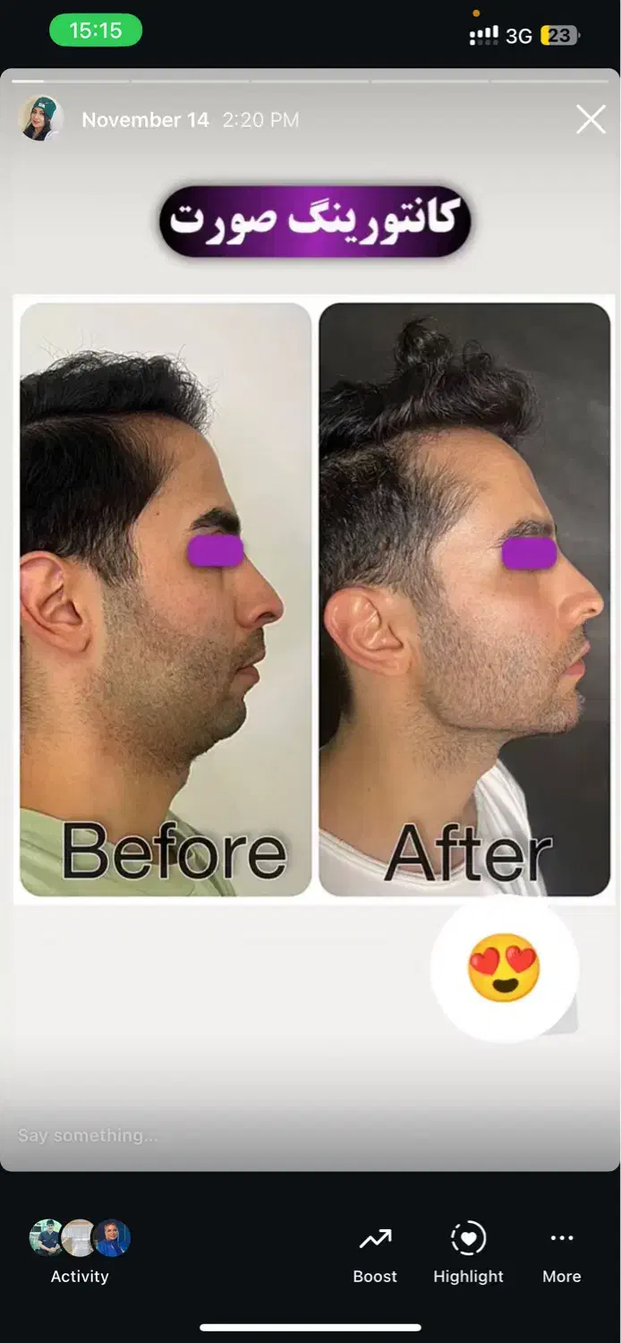 جشنواره فول فیس توسط پزشک متخصص|خدمات آرایشگری و زیبایی|تهران, ونک|دیوار