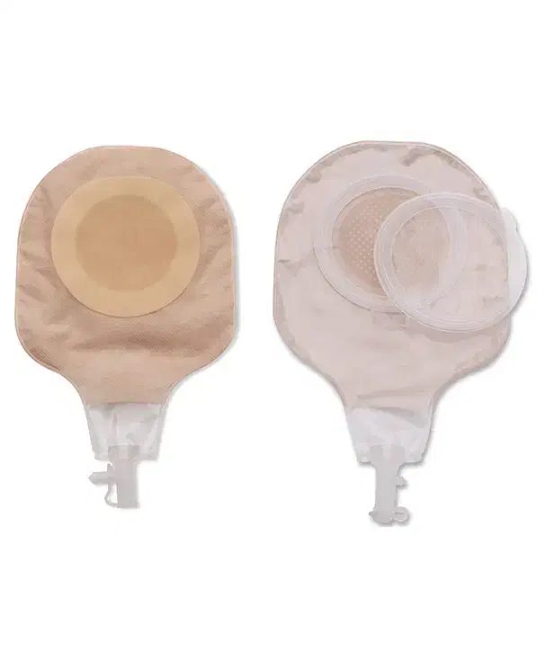 یوروستومی|پزشکی|بم, |دیوار