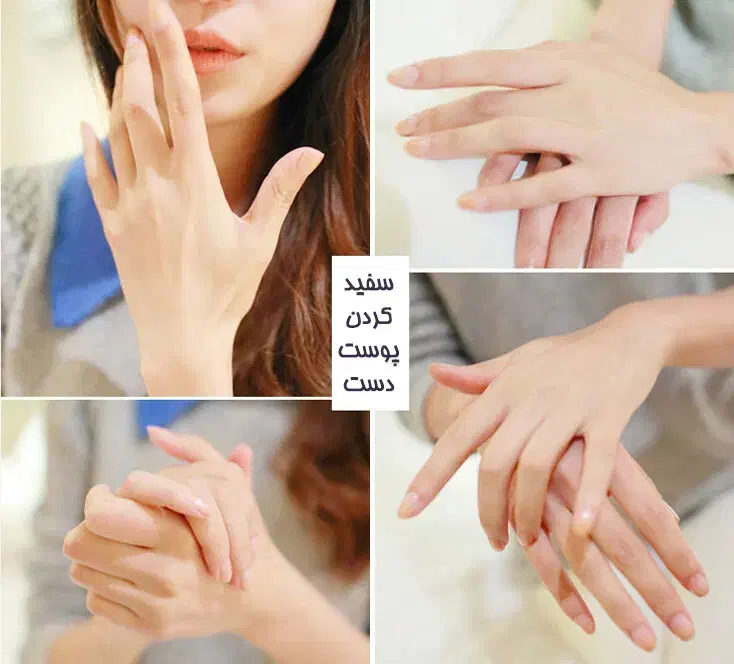 فرمول سفیدکننده قوی و بدون بازگشت|آرایشی، بهداشتی، درمانی|ایرانشهر, |دیوار