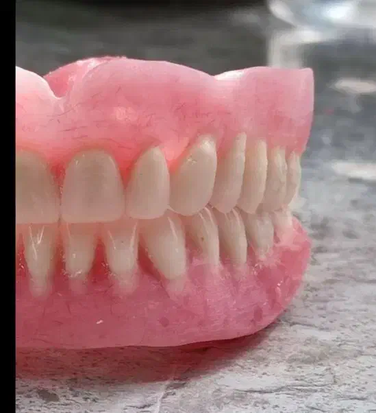 دندانسازی (دندان مصنوعی)|آرایشی، بهداشتی، درمانی|تبریز, |دیوار