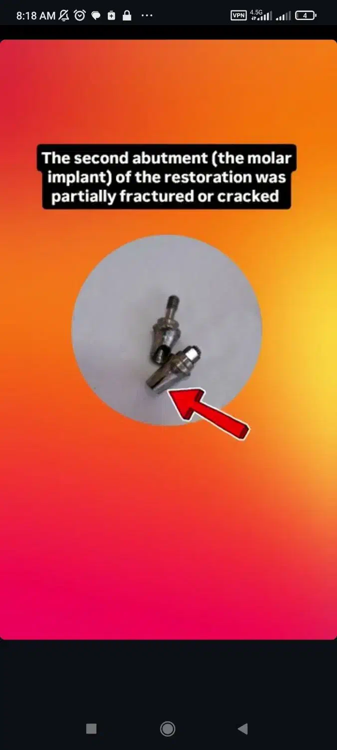 گم کردم|اشیا|اصفهان, شیخ اشراق|دیوار