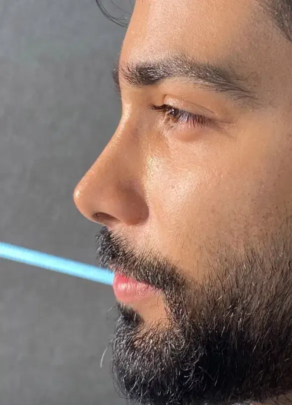 تخفیف عمل بینی لیپو ابدو ساکشن پیکرتراشی و لیفت|خدمات آرایشگری و زیبایی|بروجرد, |دیوار