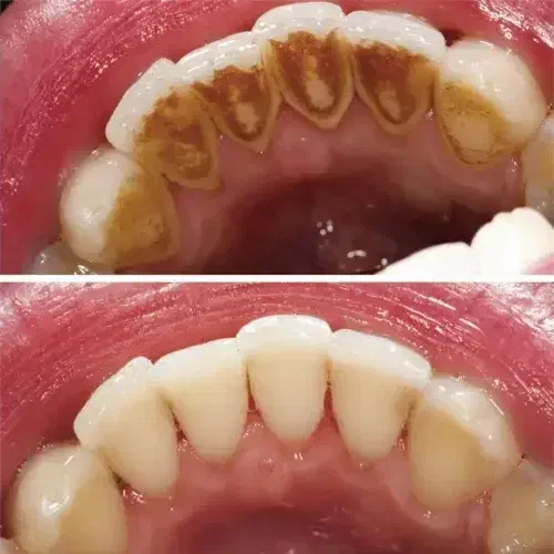 جرم گیری رایگان|خدمات آرایشگری و زیبایی|بیرجند, |دیوار