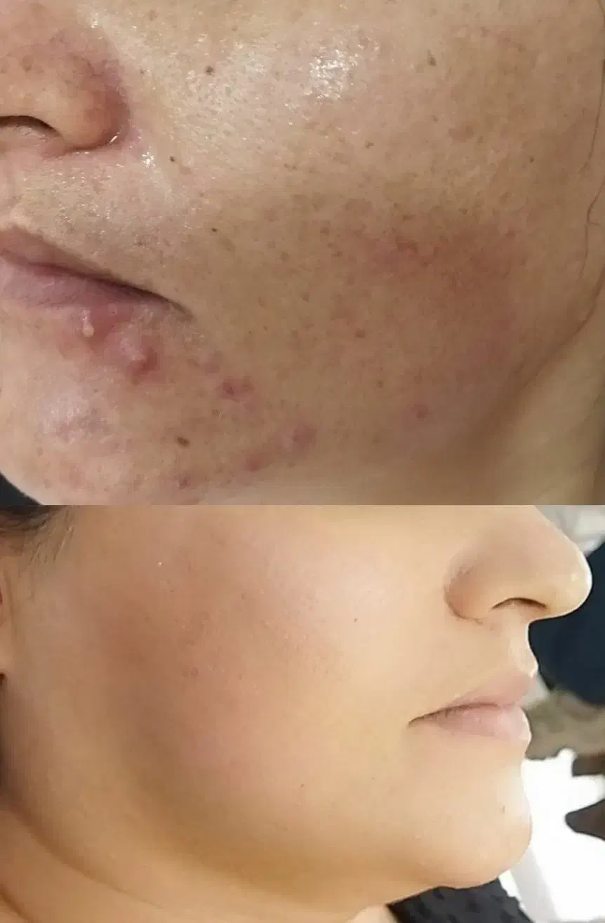 جوانسازی فوق معجزه صورت|خدمات آرایشگری و زیبایی|خوی, |دیوار