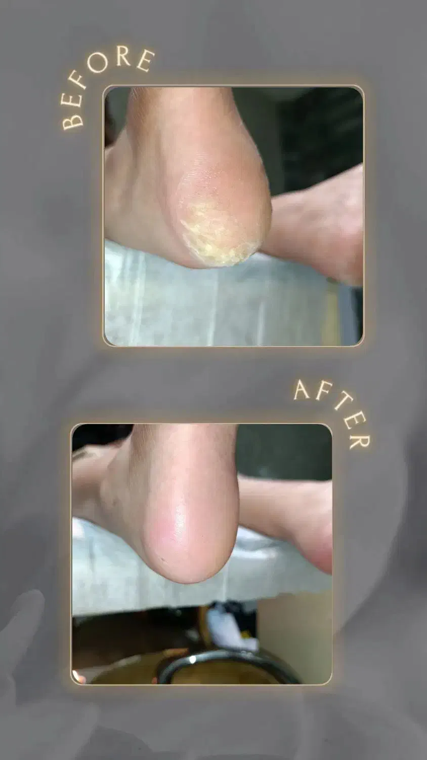 کاشت ناخن و درمان ترک پا|خدمات آرایشگری و زیبایی|مرودشت, ژیان|دیوار