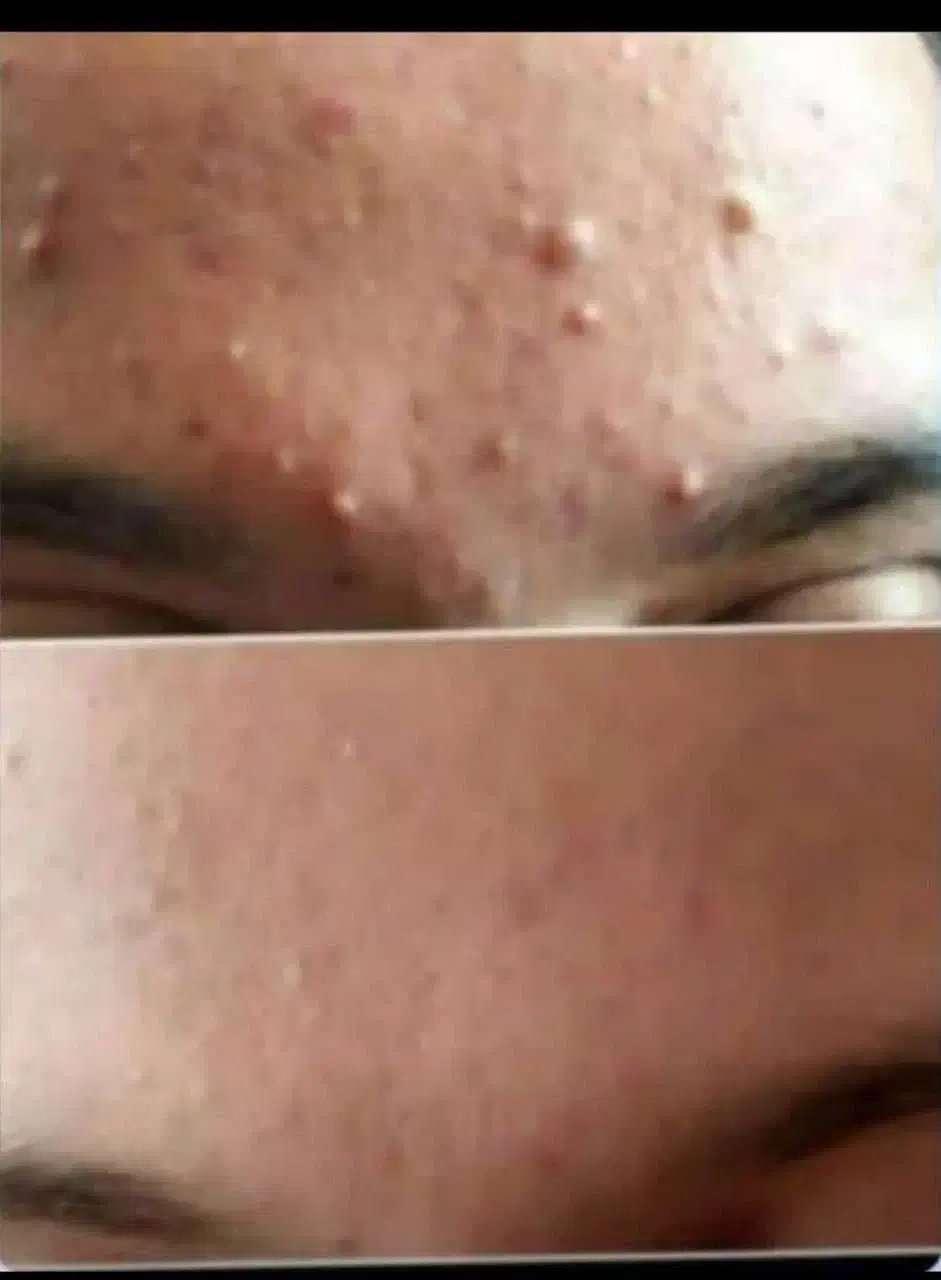 متخصص پوست و موهمراه مشاوره‌  وروتین پیشنهاد محصول|خدمات آرایشگری و زیبایی|اردبیل, |دیوار