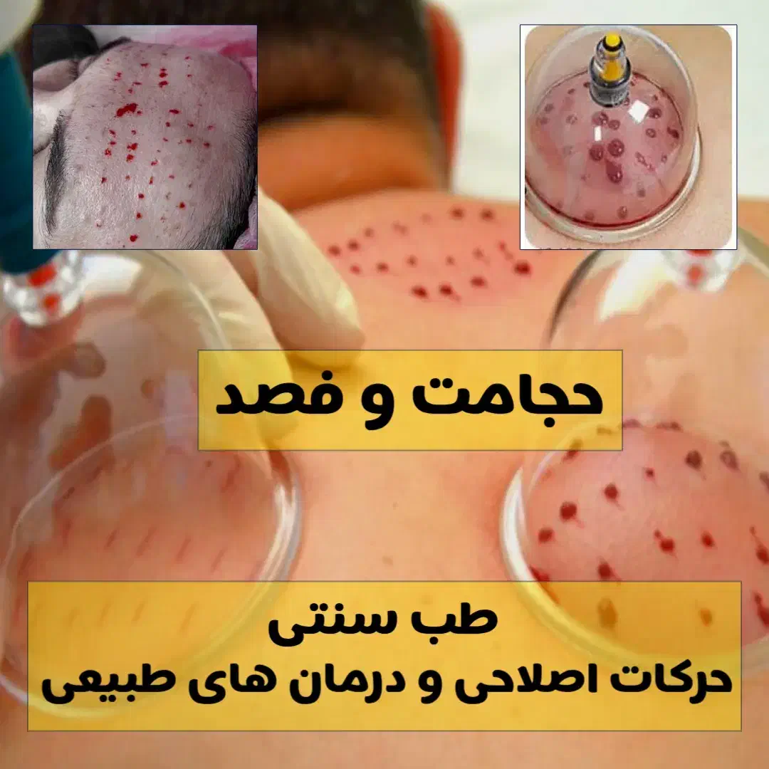 سیاتیک،حجامت،طب سنتی،مفاصل،حرکات اصلاحی|خدمات آرایشگری و زیبایی|اصفهان, ارداجی|دیوار