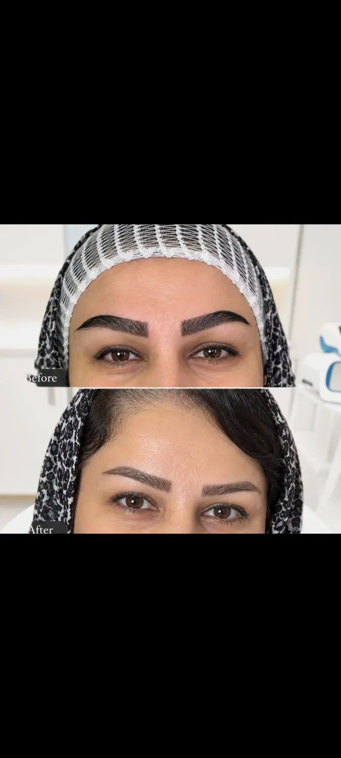 کاشت ابرو تخصصی و در آف ویژه،طبیعی و دائمی|خدمات زیبایی و سلامت|اهواز, گلستان|دیوار