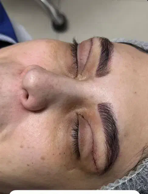 بلفاروپلاستی،لیفت ابرو،لیفت شقیقه،دایرکت ابرو|خدمات آرایشگری و زیبایی|ارومیه, |دیوار