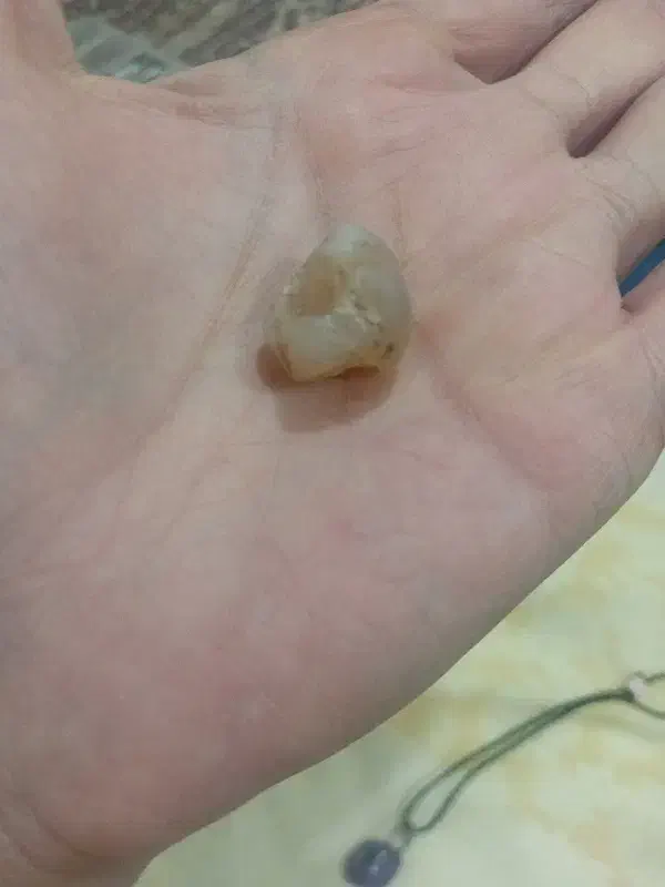 سنگ زینتی|جواهرات|رشت, پورسینا|دیوار