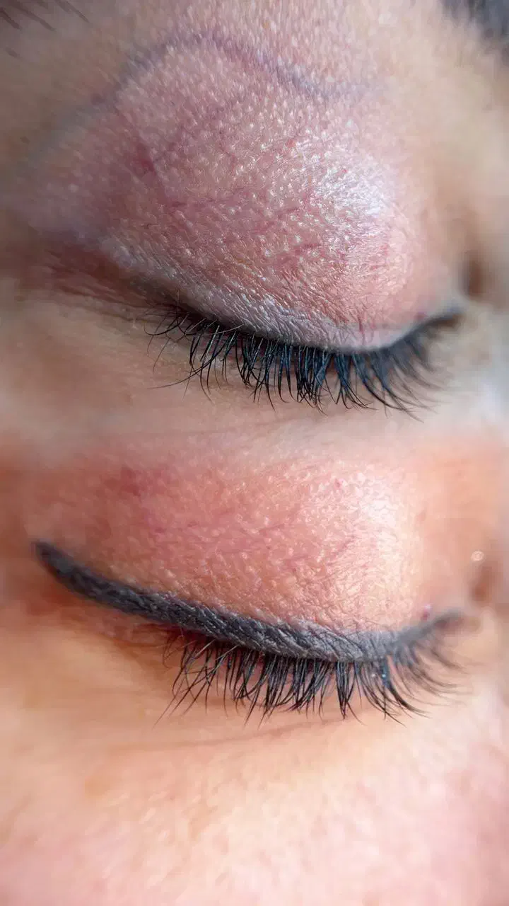 ریموو تخصصی درتربت جام|خدمات آرایشگری و زیبایی|تربت جام, والفجر|دیوار