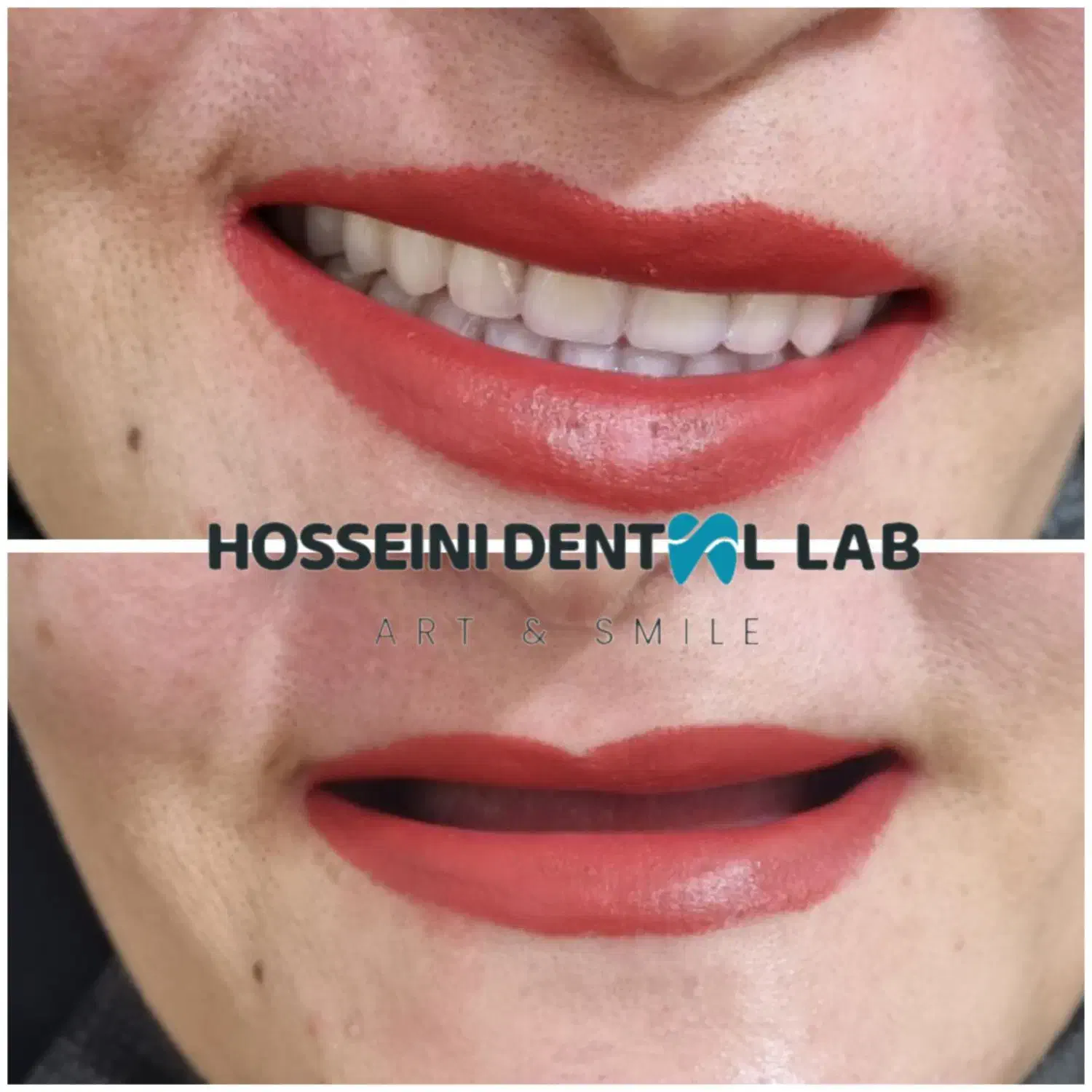 دندانسازی(بلوارهدایت)دندان مصنوعی/دندان سازی|خدمات آرایشگری و زیبایی|مشهد, هدایت|دیوار