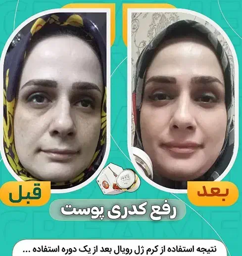 کرم ژل رویال صد در صد تضمینی|آرایشی، بهداشتی، درمانی|شیراز, حافظیه|دیوار