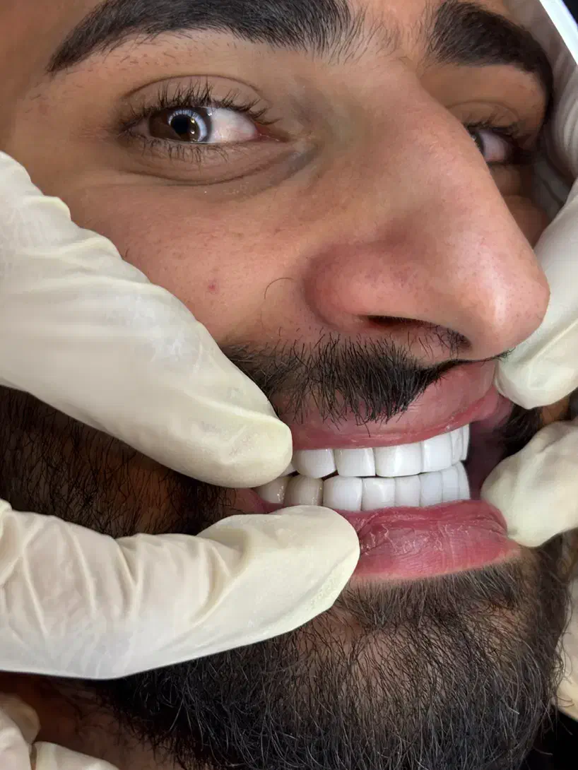 یلدا با تخفیف کامپوزیت|خدمات آرایشگری و زیبایی|ارومیه, |دیوار