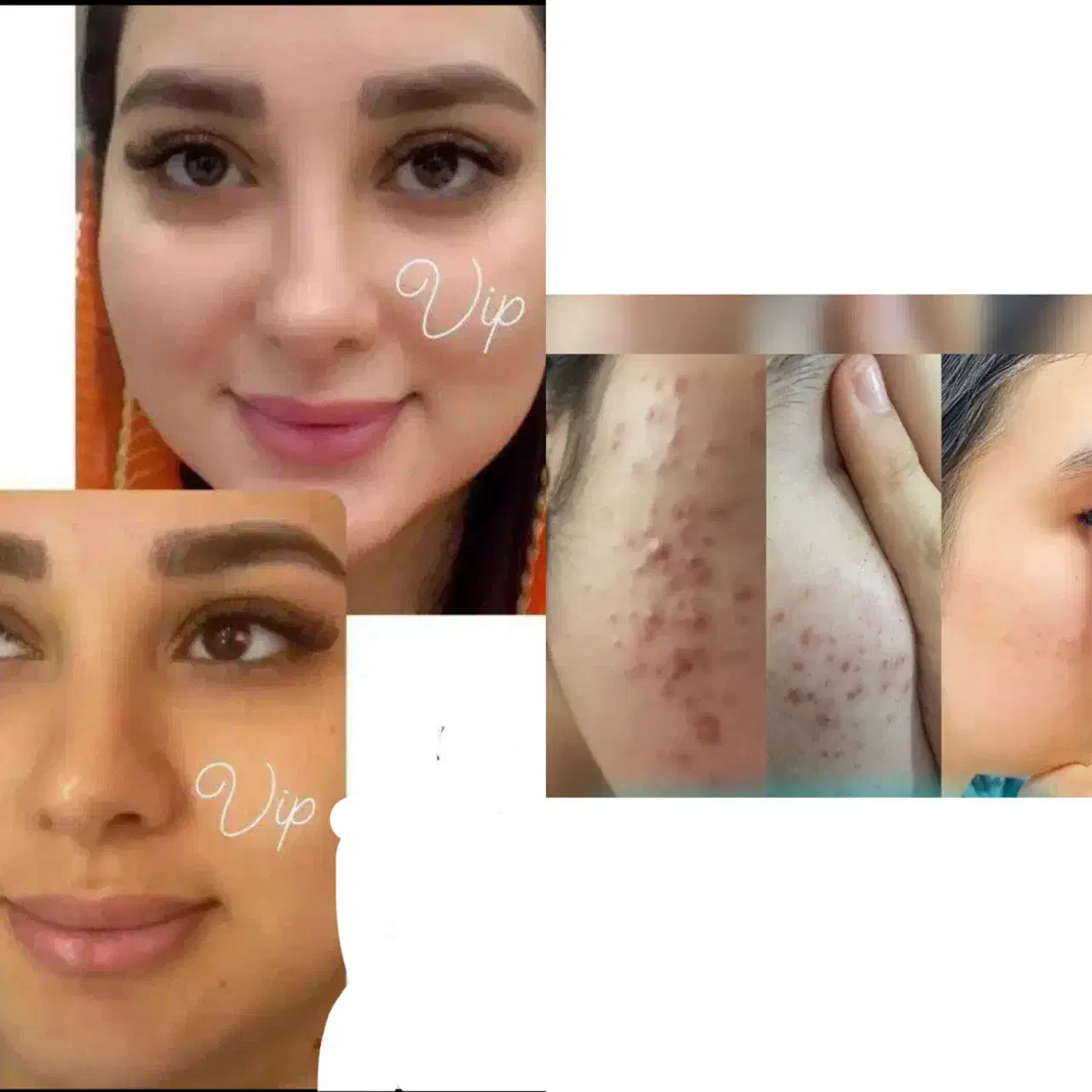 کرم تضمینی صورت معجزه|آرایشی، بهداشتی، درمانی|خاش, |دیوار