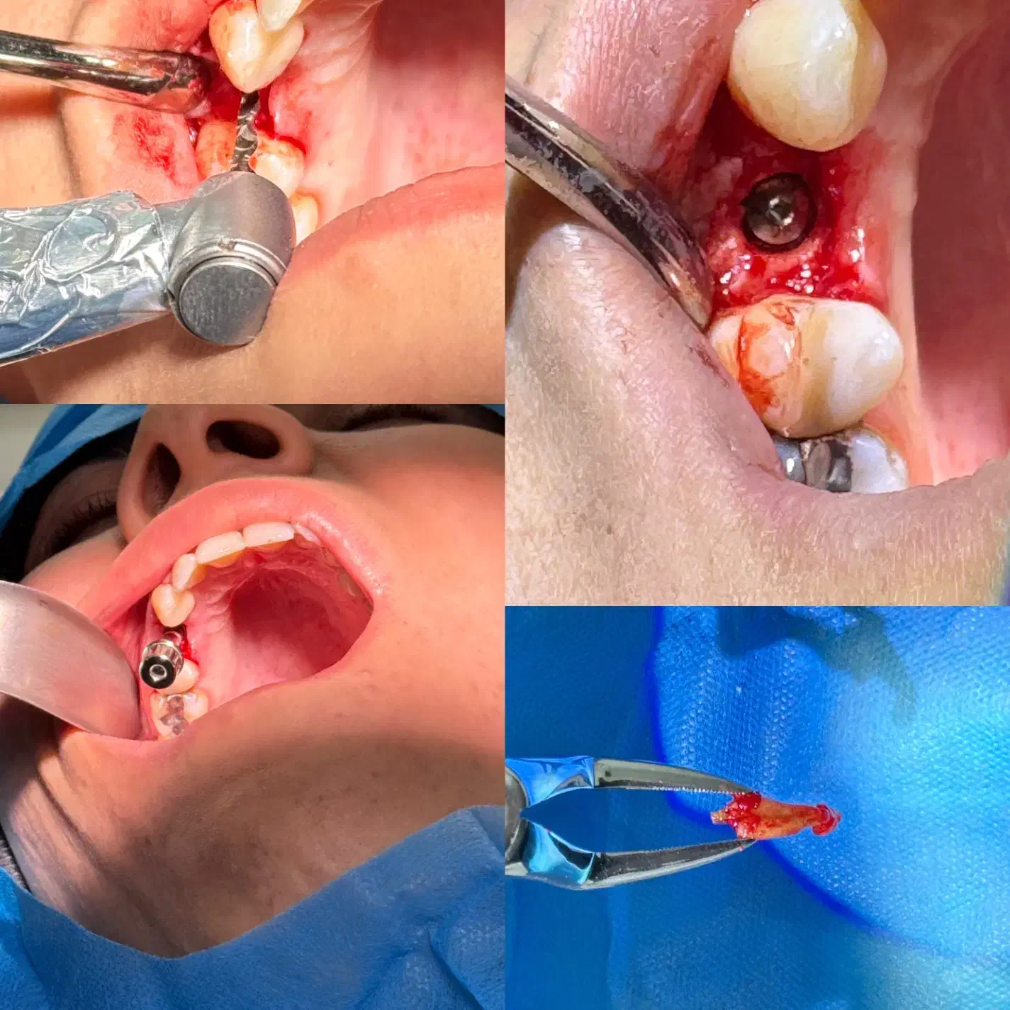 مطب دندانپزشکی بیمه ملت (شهرداری)|خدمات آرایشگری و زیبایی|ارومیه, |دیوار