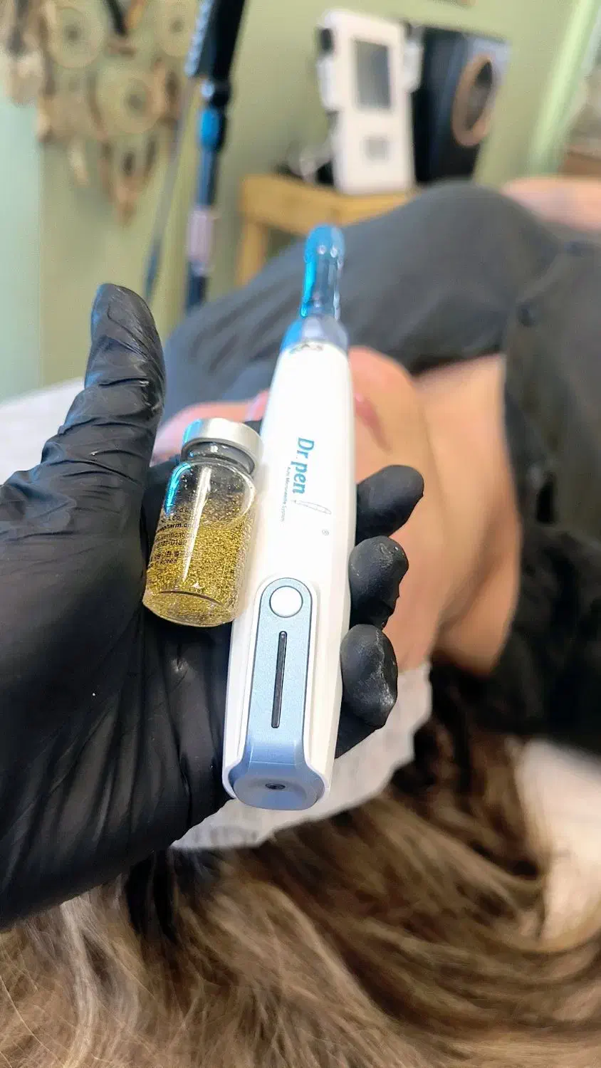 آموزش صفر تا صد میکرونیدلینگ با تخفیف ویژه|خدمات آموزشی|کرمانشاه, |دیوار