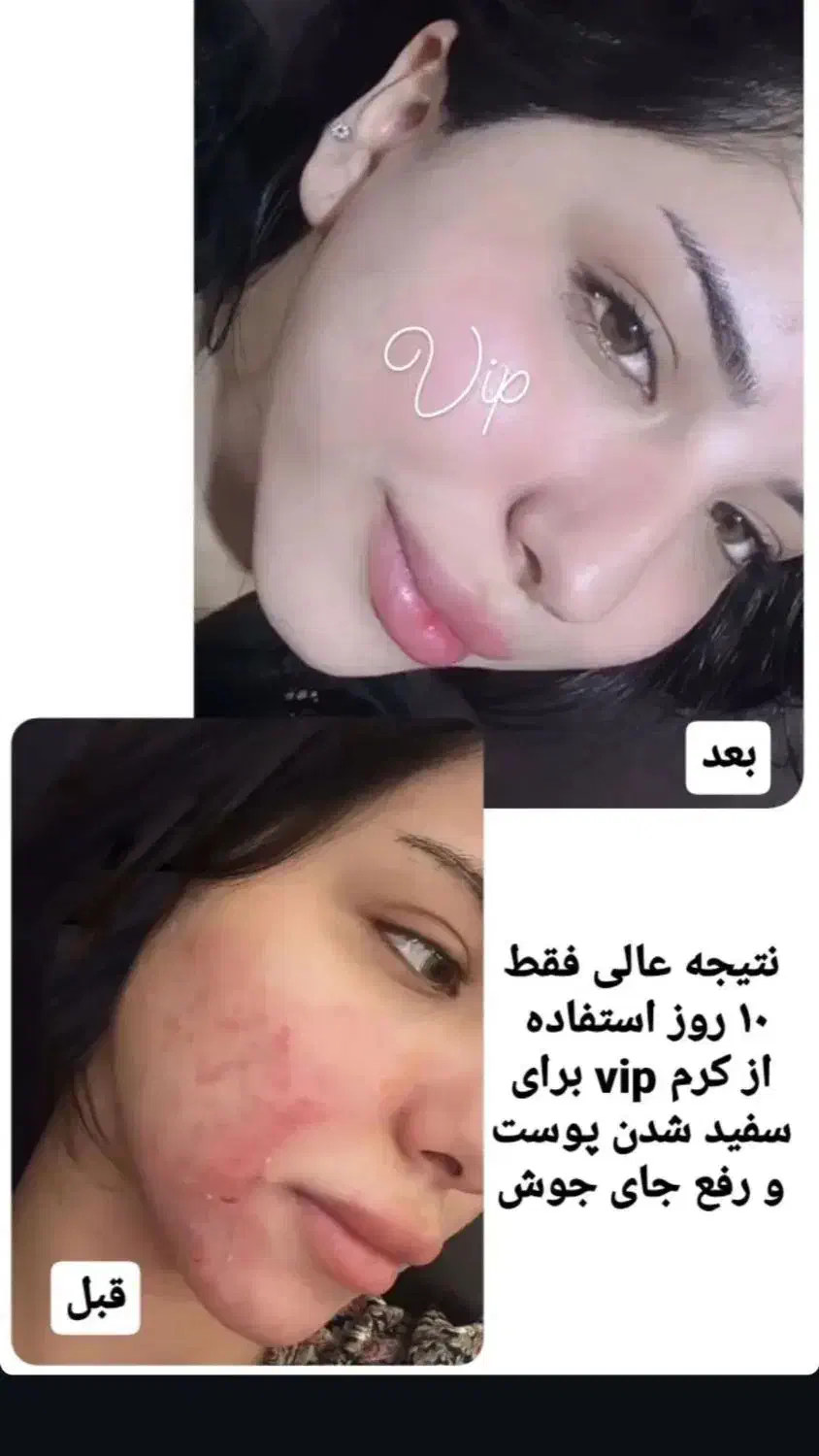 کرم سفید کننده|آرایشی، بهداشتی، درمانی|زابل, |دیوار