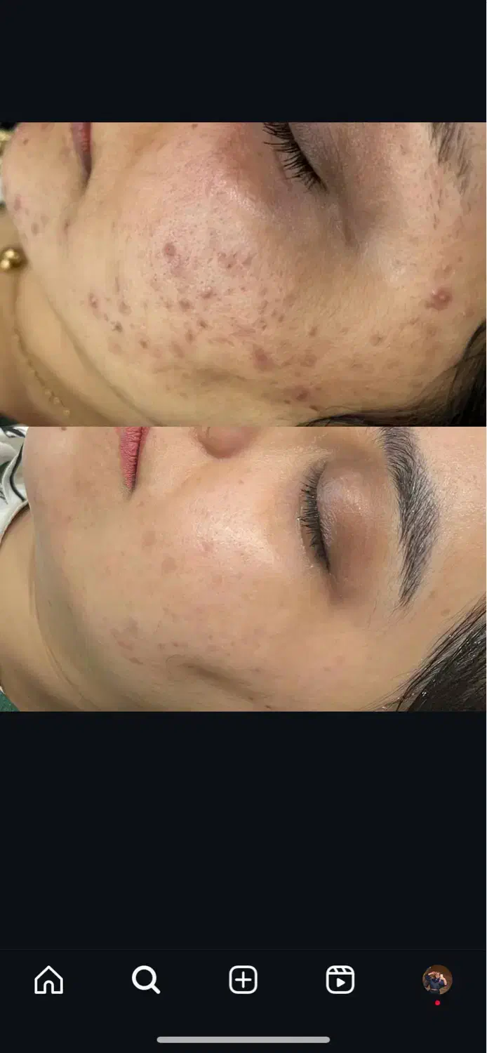 فیشال پوست برای خانمهاوآقایان|خدمات آرایشگری و زیبایی|کرمانشاه, |دیوار