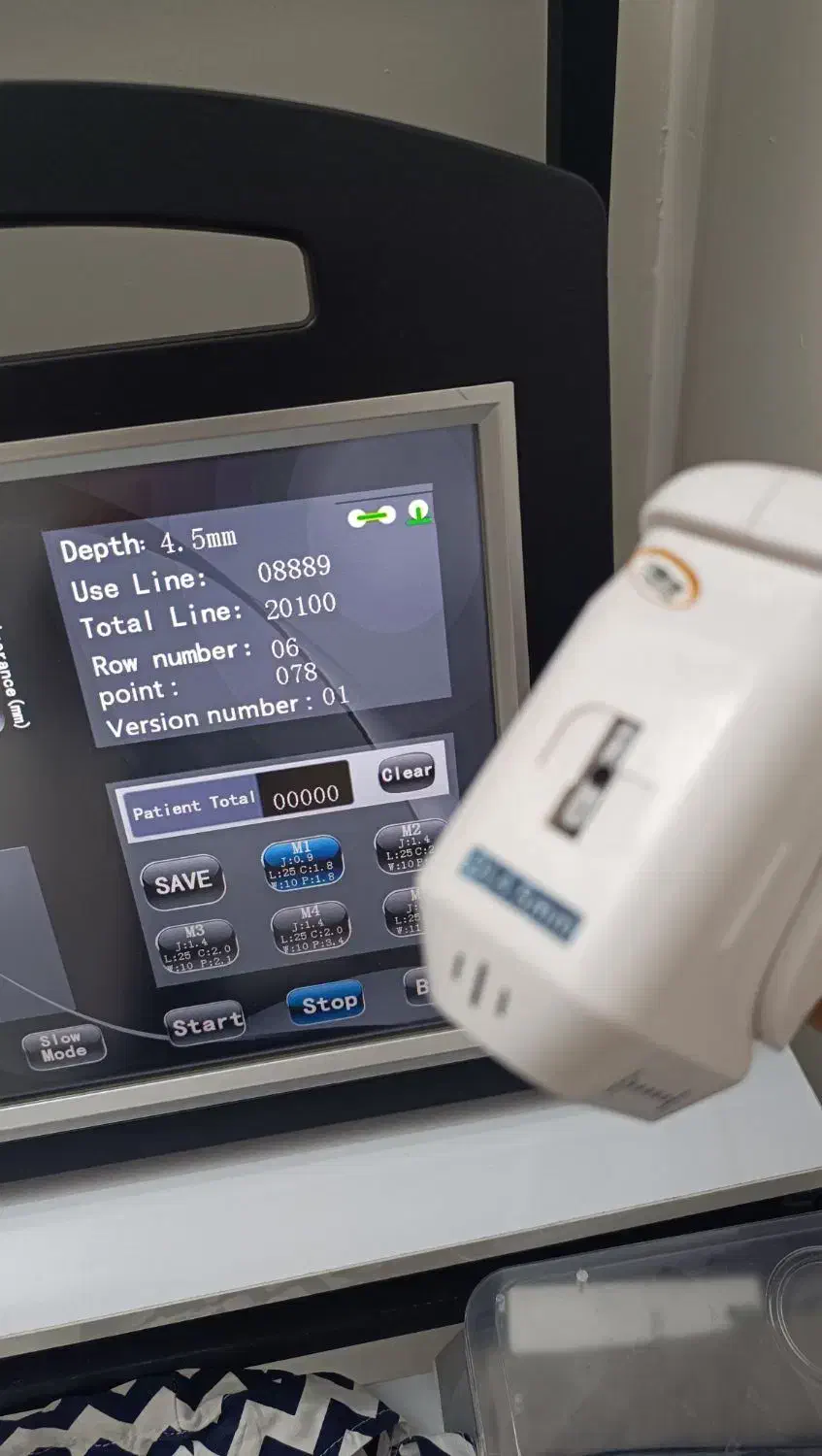 فروش دستگاه هایفوتراپی|آرایشگاه و سالن‌های زیبایی|کاشمر, |دیوار