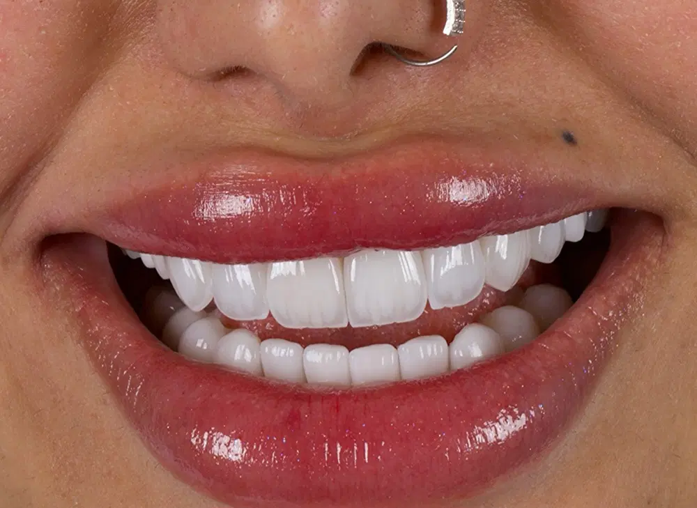 دندانپزشکی دیجیتال و تخصصی|خدمات زیبایی و سلامت|شیراز, خلیلی|دیوار