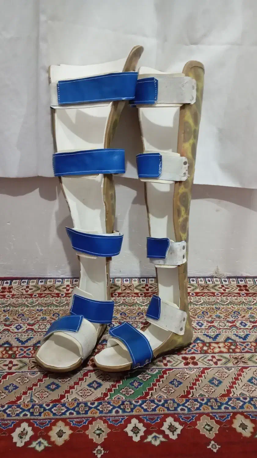 آتل پا|آرایشی، بهداشتی، درمانی|شیراز, جوادیه|دیوار