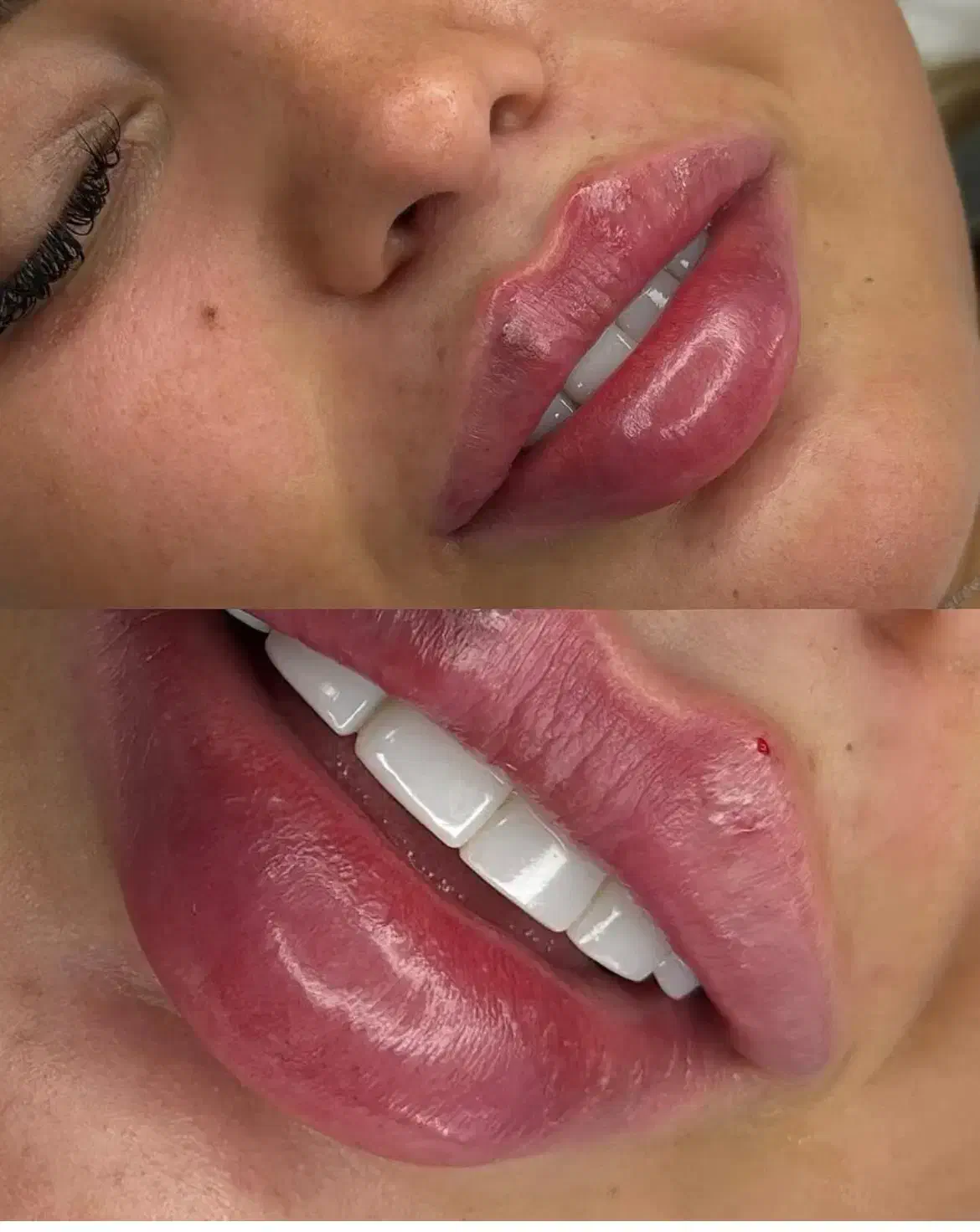 جشنواره تخفیف ژل لبروسی،فیلرشقیقه،بوتاکس توسط پزشک|خدمات آرایشگری و زیبایی|کرج, گلشهر|دیوار