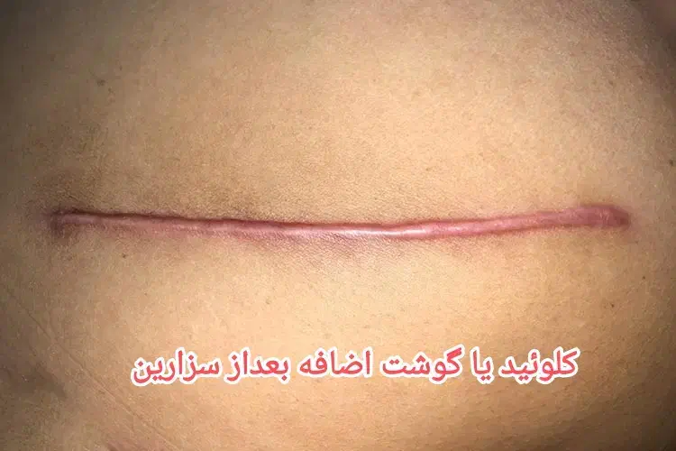 پی بی سرم کانتورینگ|خدمات آرایشگری و زیبایی|رشت, بلوار گیلان|دیوار