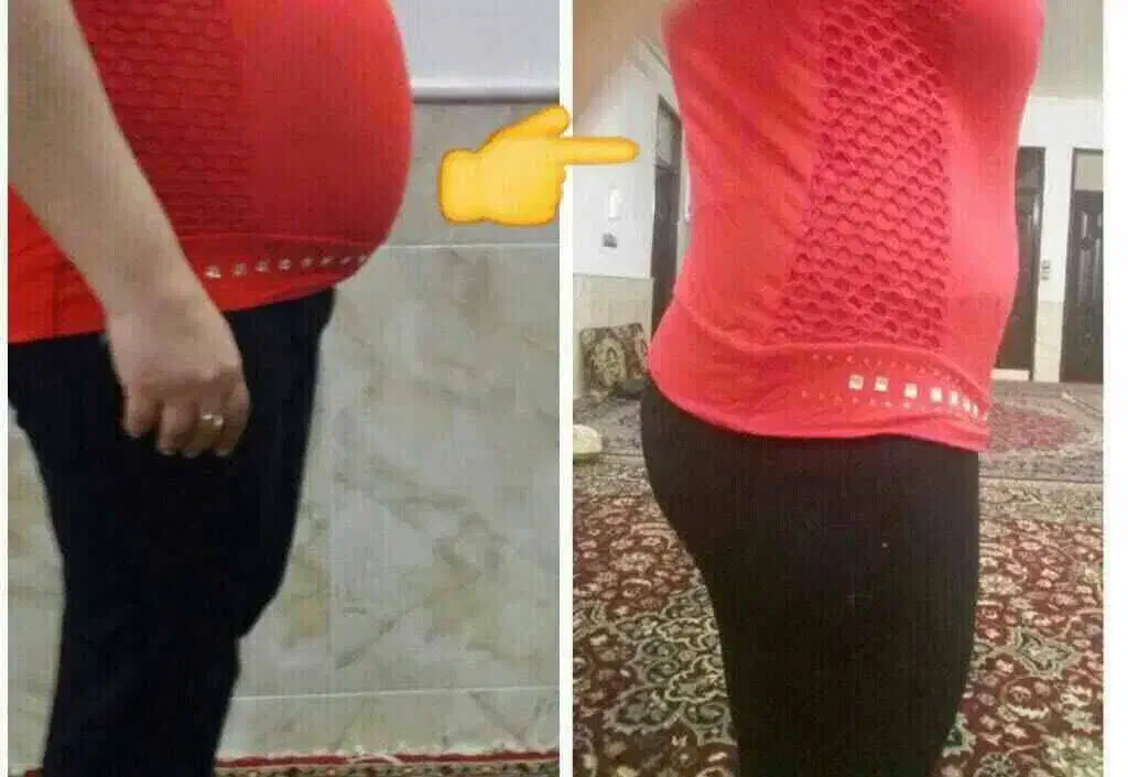 مینی پک لاغری تخفیف ویژه شب یلدا|فعالیت داوطلبانه|بندرعباس, |دیوار