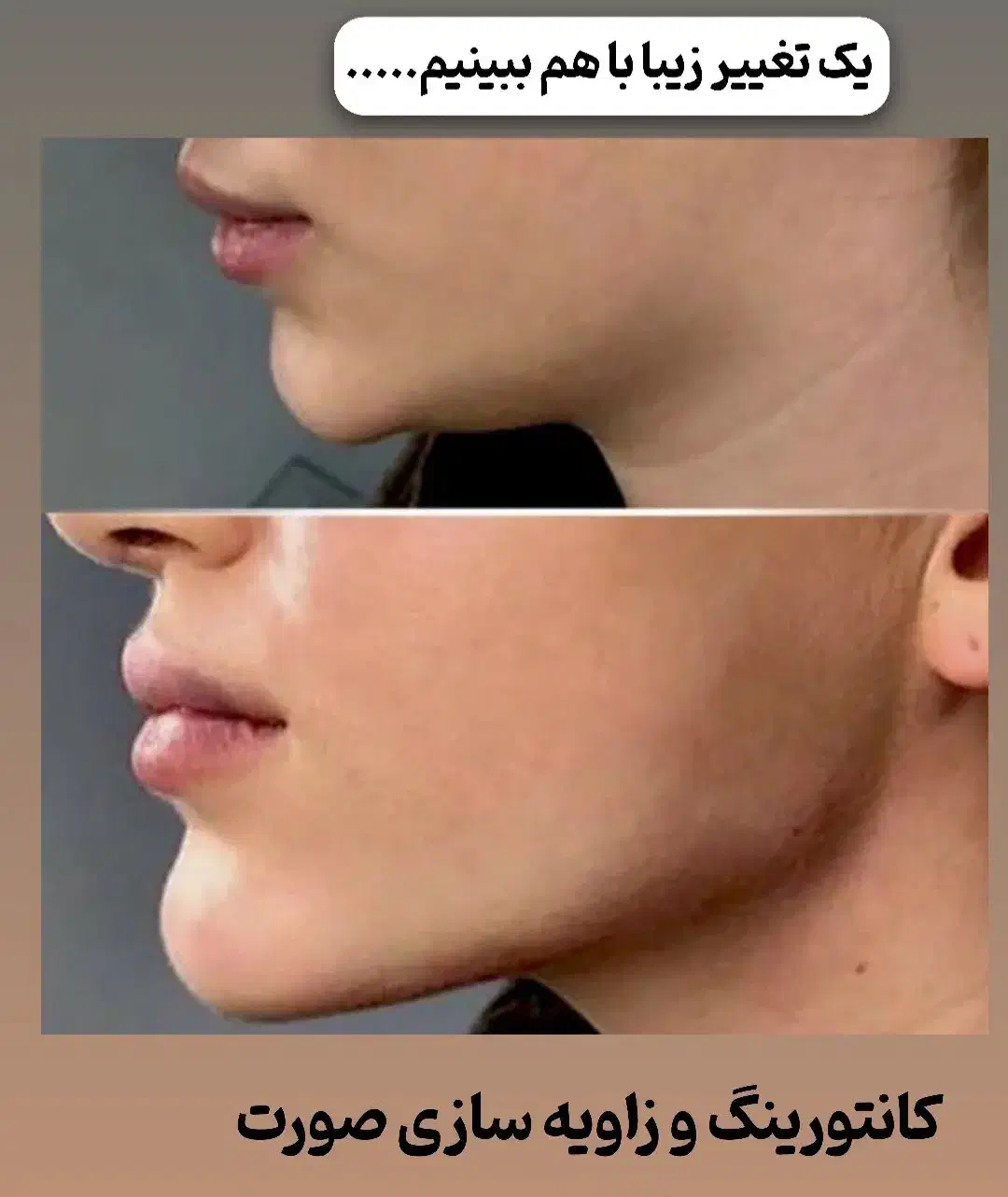 ساکشن شکم پهلو ۱۰ میلیون تومان ، پزشک ۲۰ سال تجربه|خدمات آرایشگری و زیبایی|مشهد, هفت تیر (نه دره)|دیوار