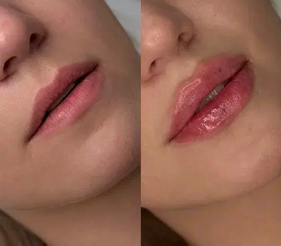 مدل جهت فیلر لیبل دار ،دارای تاییدیه بین المللی|خدمات آرایشگری و زیبایی|ری, دولت‌آباد|دیوار