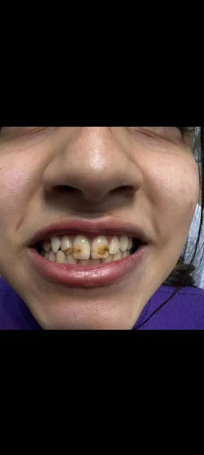 آموزش تخصصی دندانسازی و بلیچینگ و کامپوزیت|خدمات آموزشی|شیراز, معالیآباد|دیوار