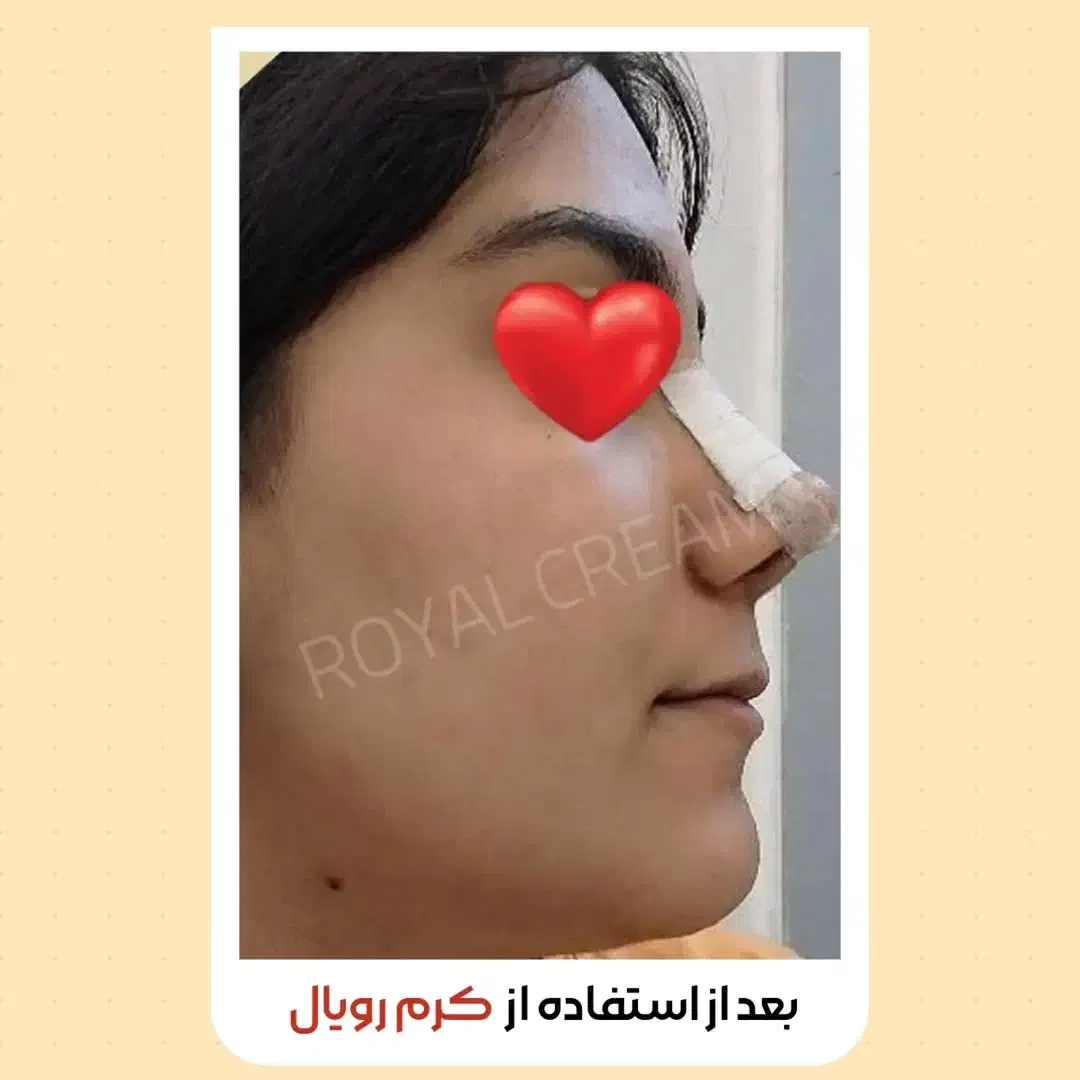 اگه دنبال پوست خوبی پیام بده|آرایشی، بهداشتی، درمانی|خلخال, |دیوار