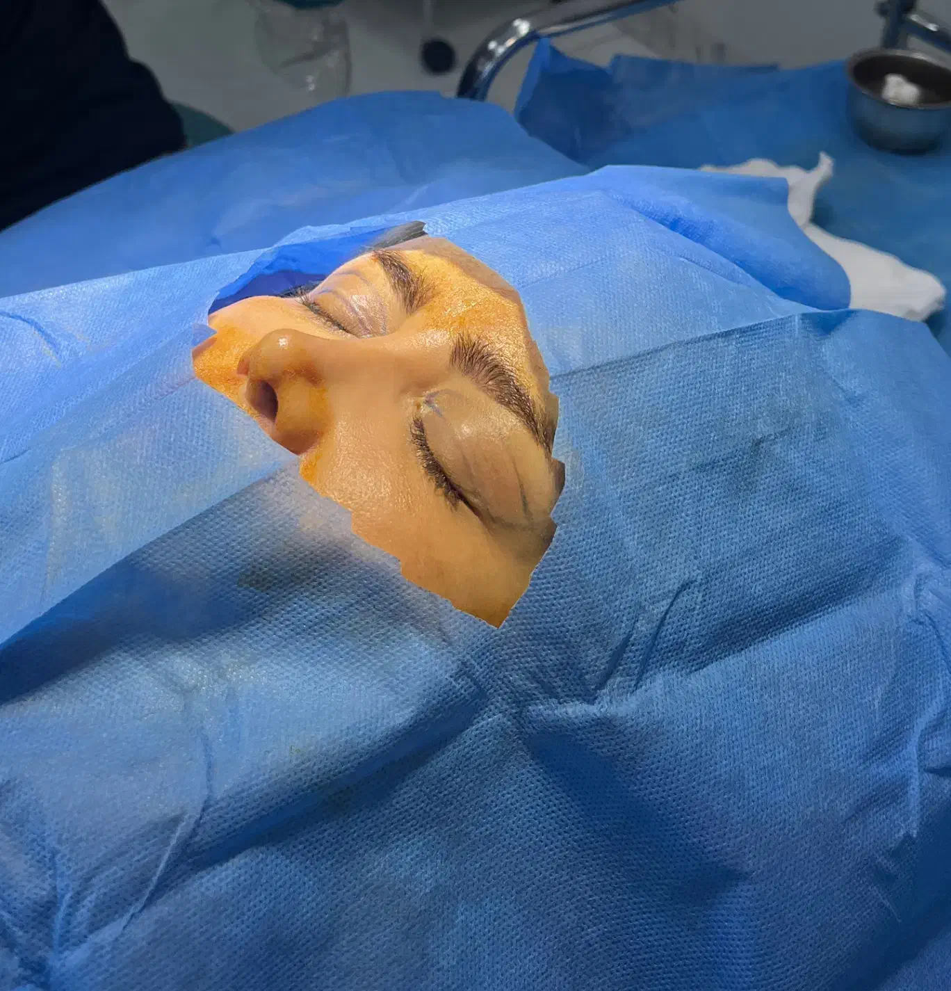 تخفیف ویژه شب یلدا برای جراحی بلفاروپلاستی|خدمات آرایشگری و زیبایی|مسجد سلیمان, |دیوار