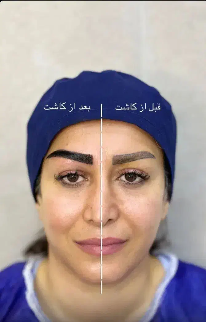 جشنواره پاییزی کاشت مو وابرو|خدمات آرایشگری و زیبایی|رباط‌کریم, رباط‌کریم|دیوار