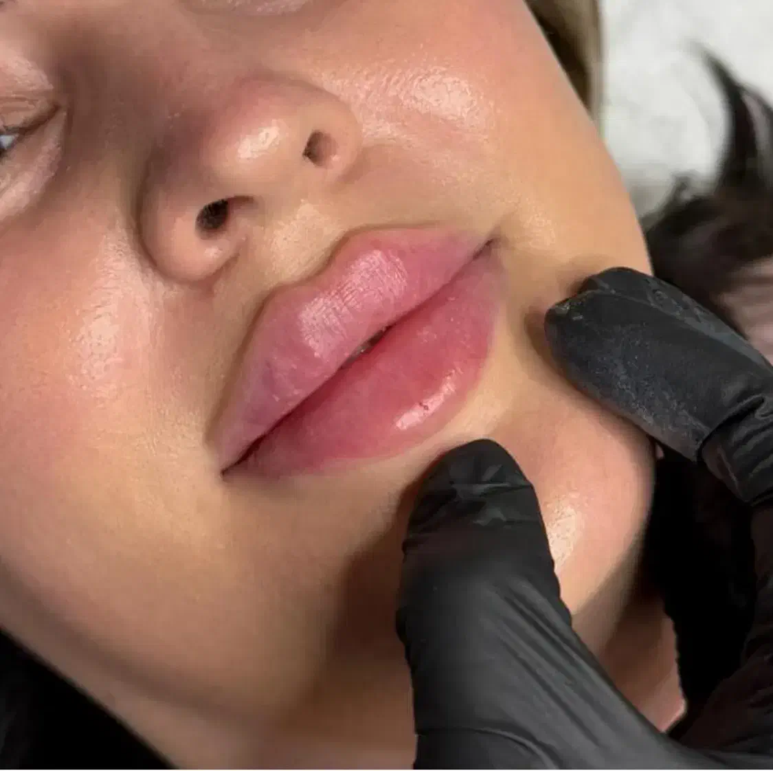 جشنواره یلدایی ژل / بوتاکس / جوانساز صورت(در مطب)|خدمات آرایشگری و زیبایی|شاهین‌شهر, فردوسی|دیوار