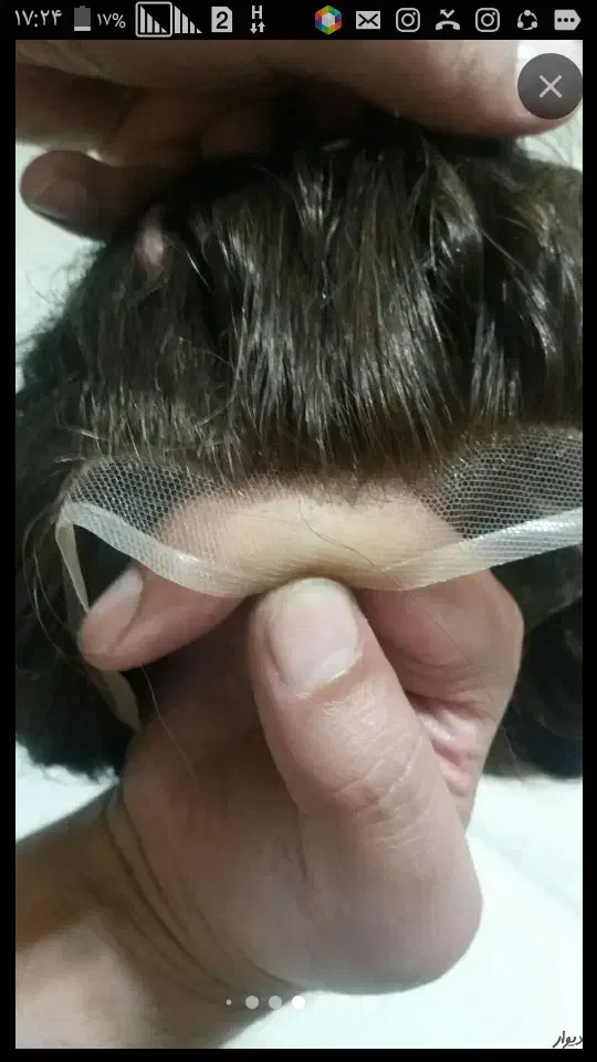 پروتز مو ترمیم|خدمات آرایشگری و زیبایی|اندیشه, اندیشه فاز ۱|دیوار