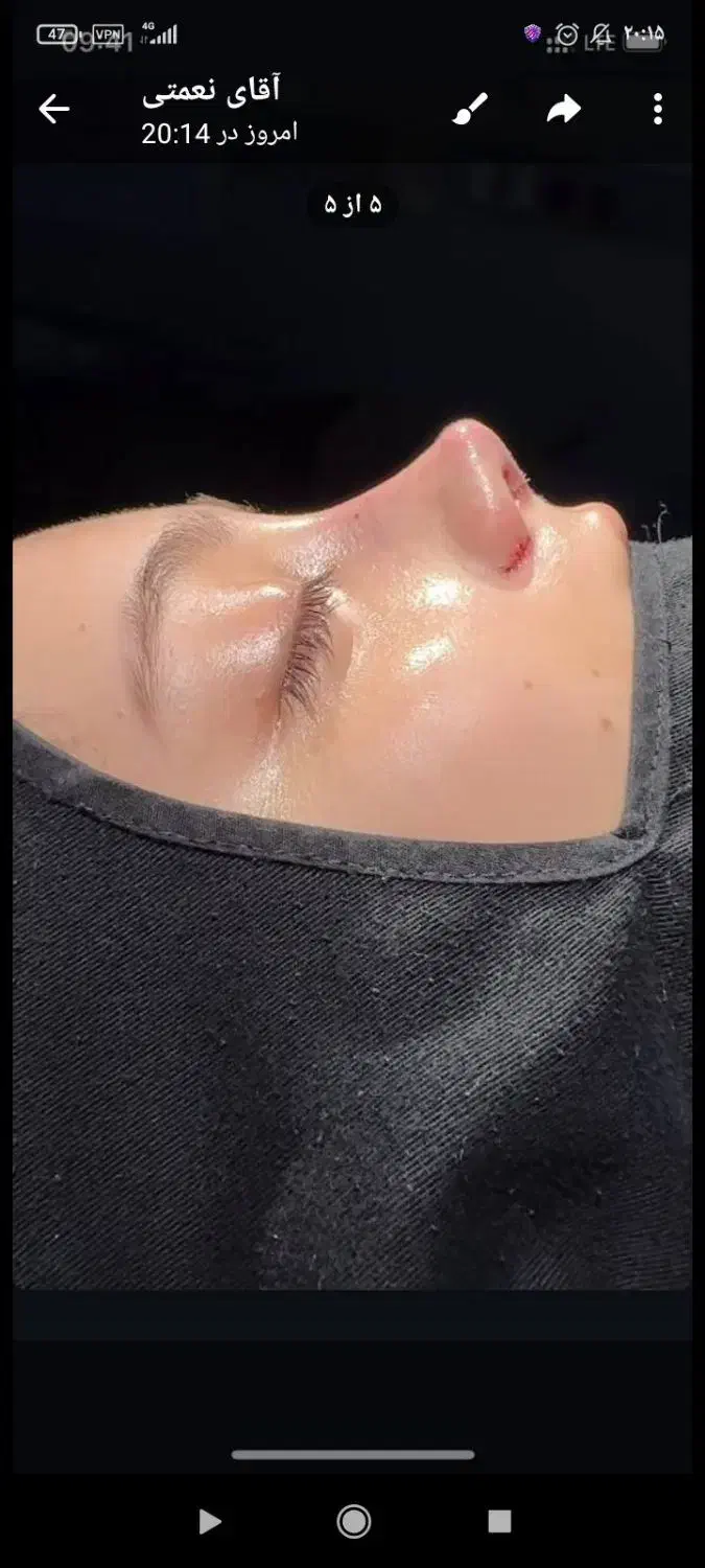 زیبایی|خدمات آرایشگری و زیبایی|نهاوند, |دیوار