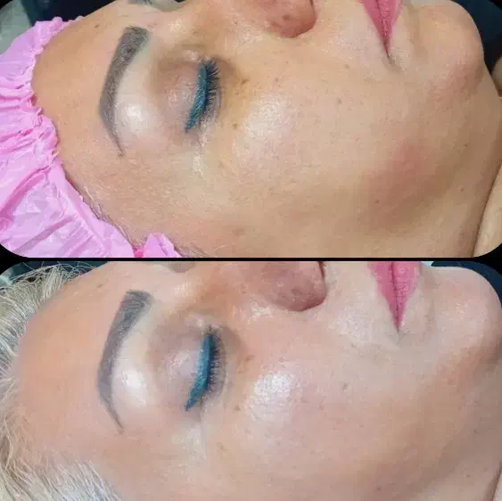 پاکسازی پوست(فیشال)|خدمات آرایشگری و زیبایی|تربتحیدریه, اندیشه|دیوار