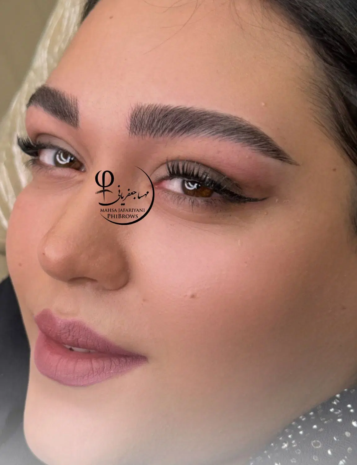 جشنواره خدمات میکرومویی وژل و بوتاکس و مزو|خدمات زیبایی و سلامت|مشهد, طلاب|دیوار