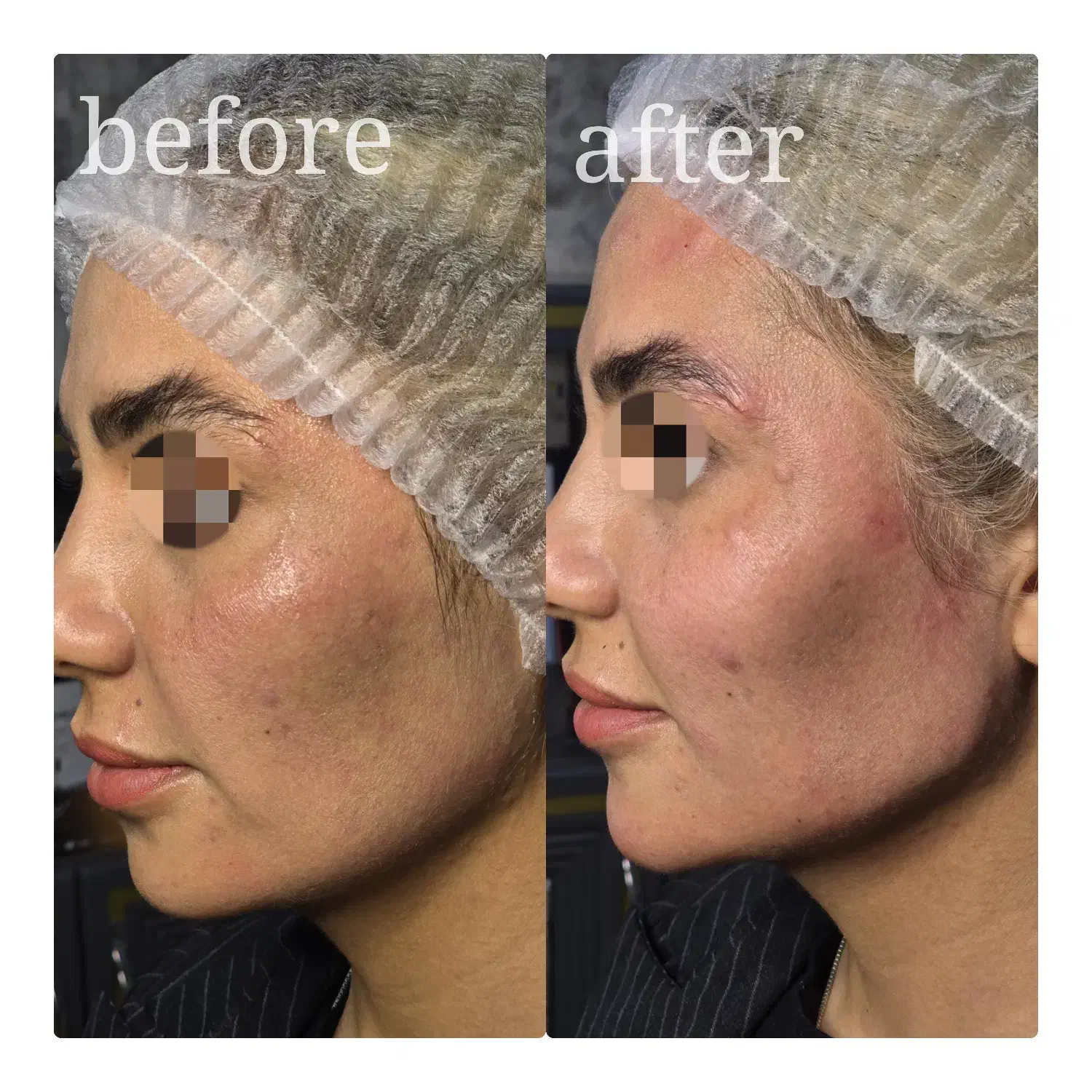 جشنواره تخفیف هفتگی ویژه نخ،مادلینگ فول فیس|خدمات آرایشگری و زیبایی|شاهین‌شهر, فردوسی|دیوار