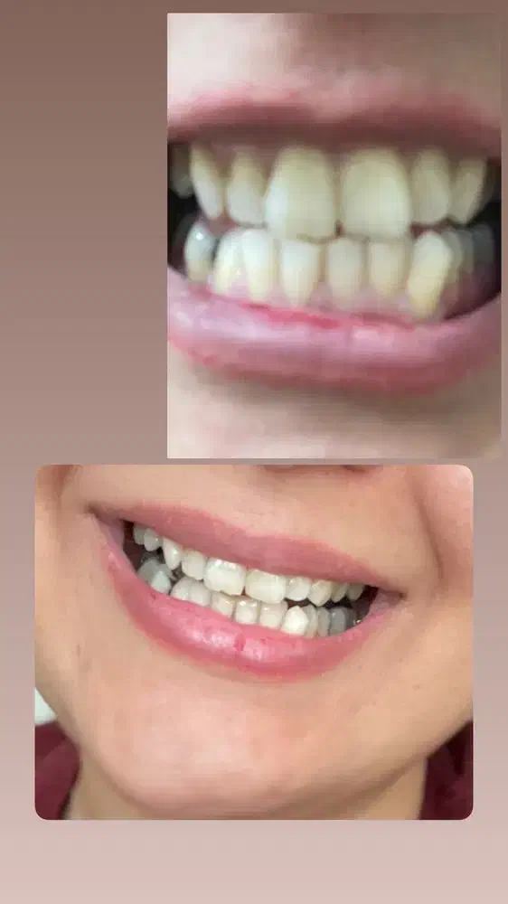 ازبین بردن جرم و پلاک دندان خوشبو کننده دهان گیاهی|آرایشی، بهداشتی، درمانی|اهواز, آریاشهر|دیوار